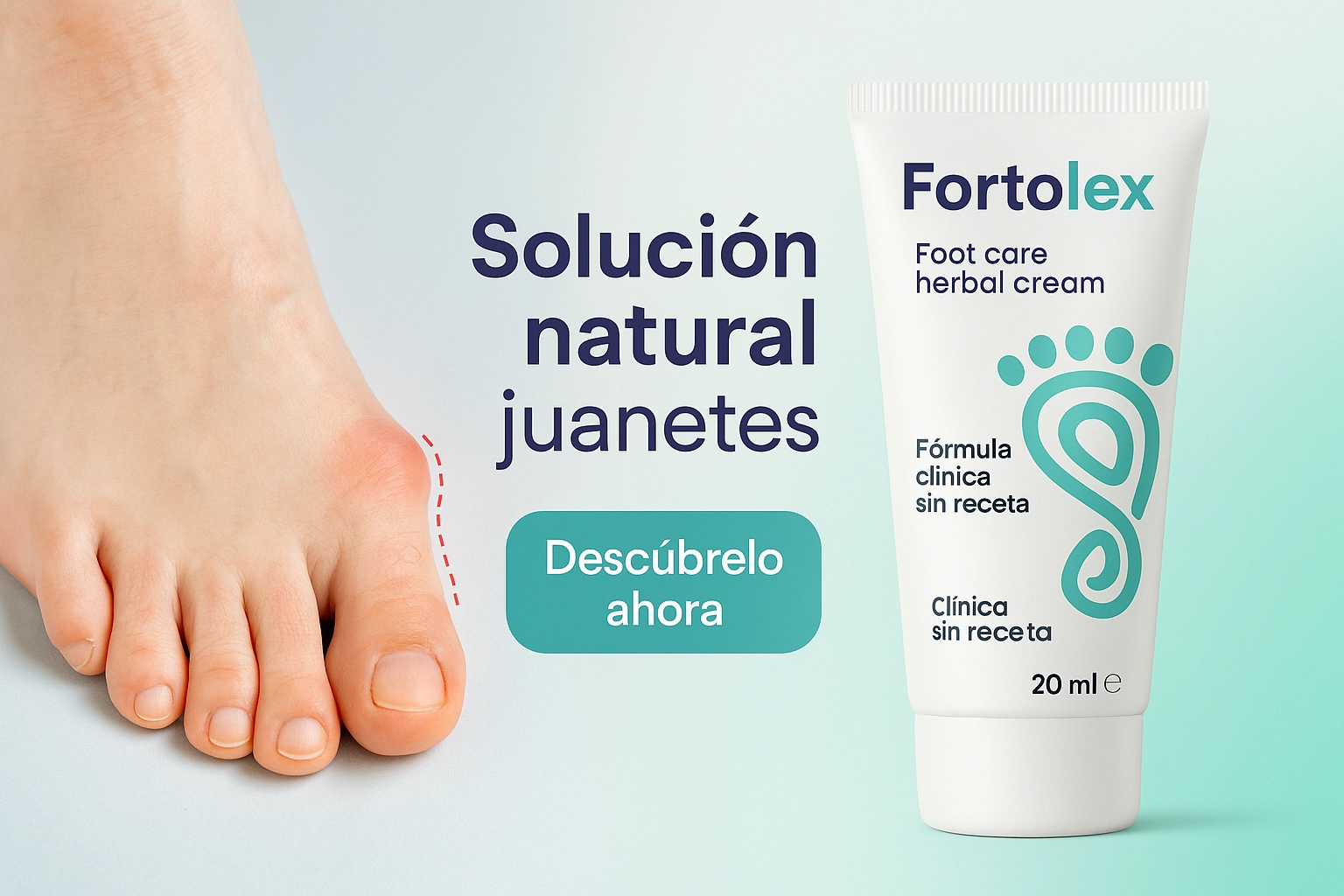 Fortolex crema natural para tratar juanetes en España